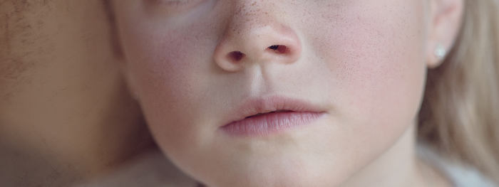 rinitis alergica y ortodoncia ,funciones de la nariz
