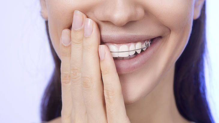 retenedores ortodoncia