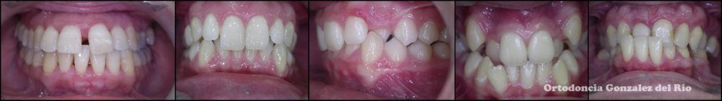 La importancia del diagnostico en ortodoncia,diferentes origenes