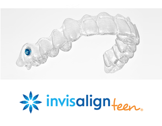 invisalign