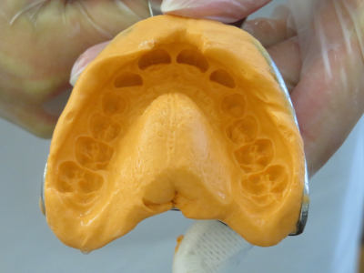ortodoncia y dolor,medidas de ortodoncia