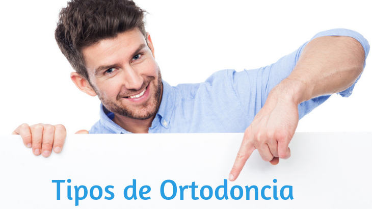 tipos de ortodoncia de adultos en Marbella