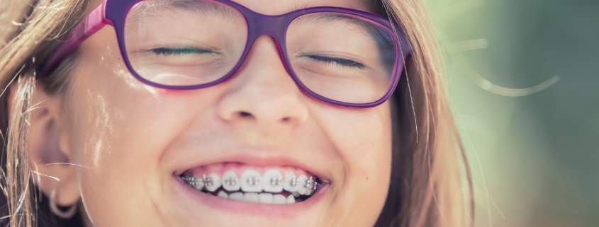 Brackets Marbella