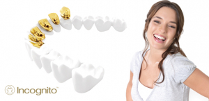 Paciente adulto sonriendo sin que se note su tratamiento de ortodoncia lingual