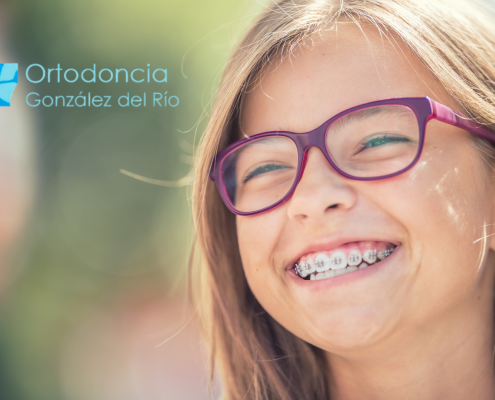 Brackets en Marbella