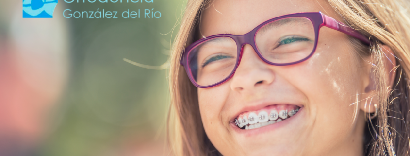 Brackets en Marbella