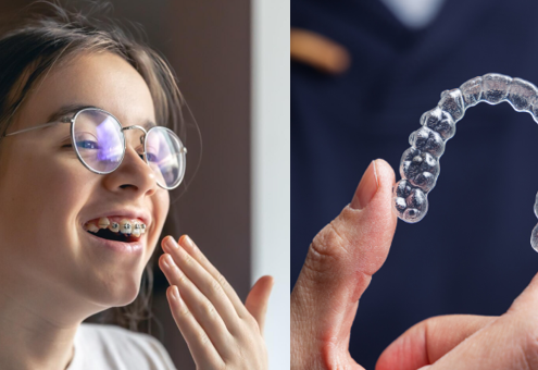 Invisalign y Brackets